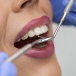 dental treatment 1