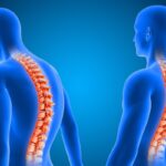 scoliosis surgery cost in turkey 2024