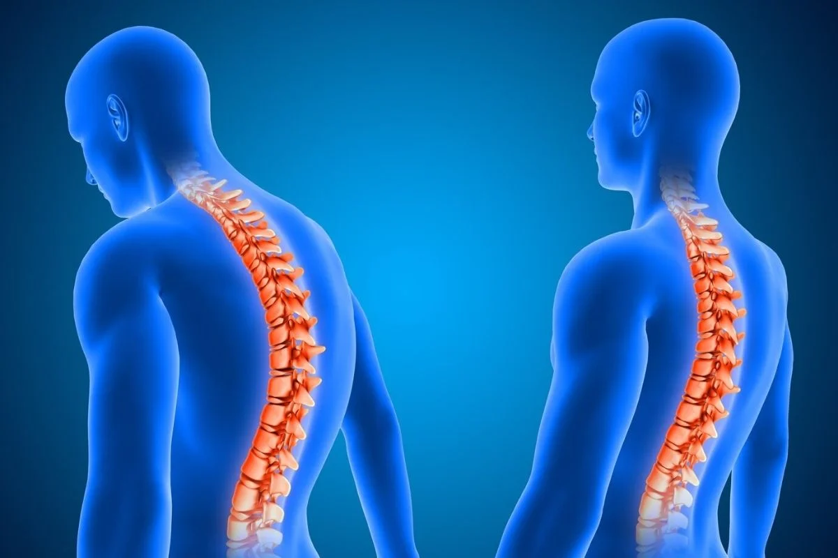 scoliosis surgery cost in turkey 2024